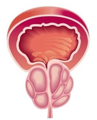 Sintomi della prostatite negli uomini