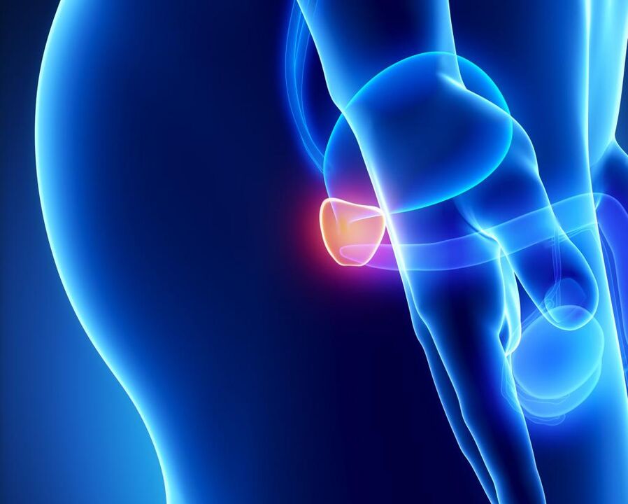 Infiammazione della ghiandola prostatica